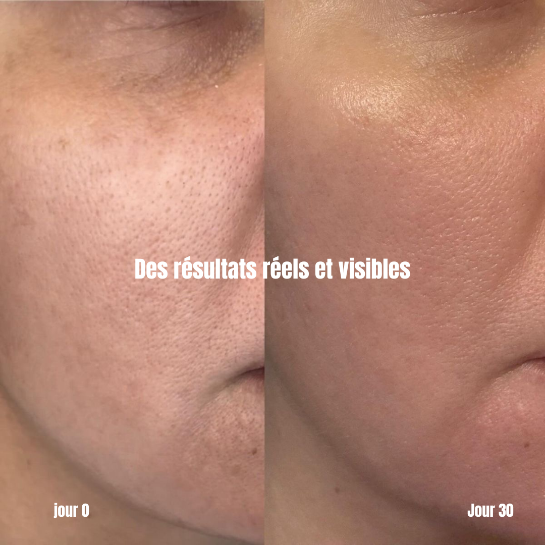LumiSkin LED Therapy Mask